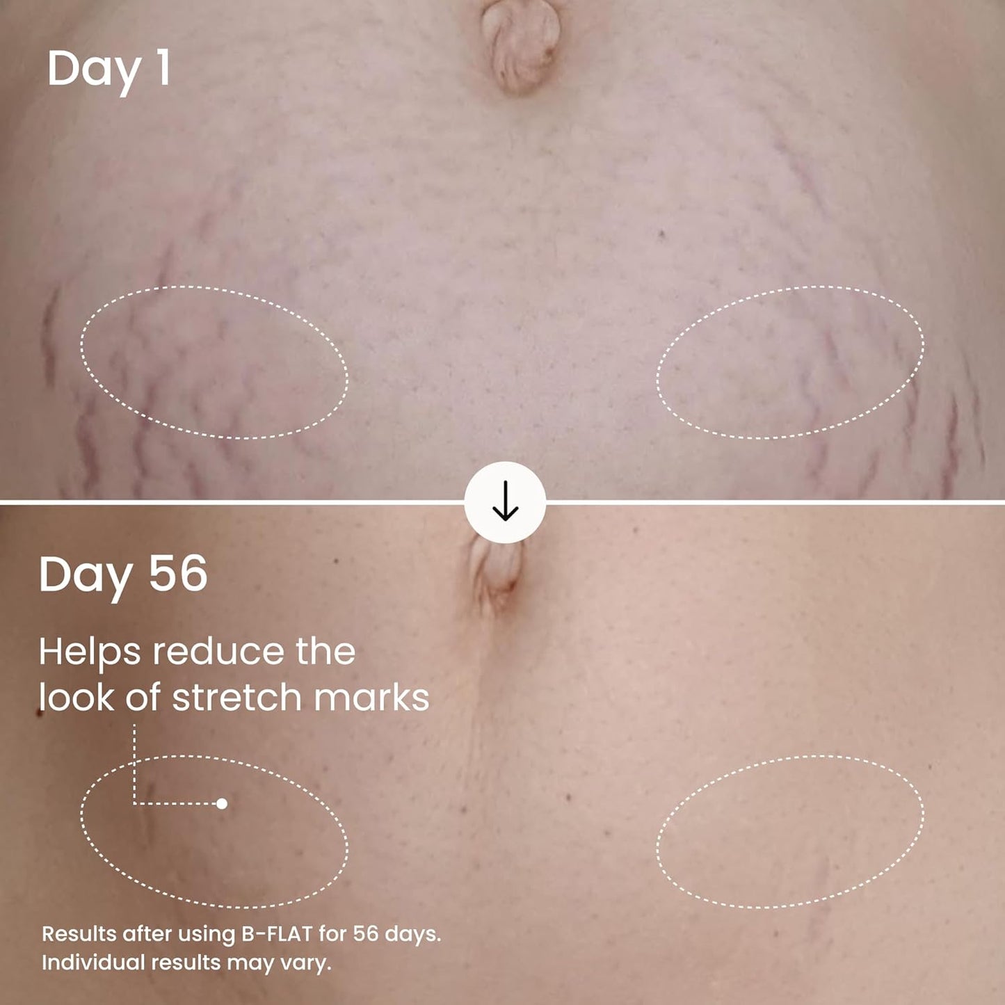 Visibly Firm & Smooth Your Belly