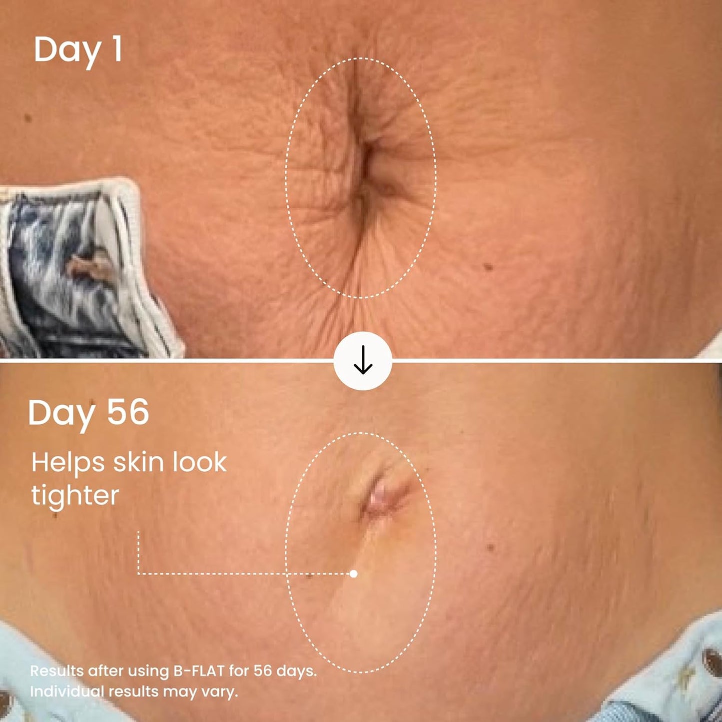 Visibly Firm & Smooth Your Belly